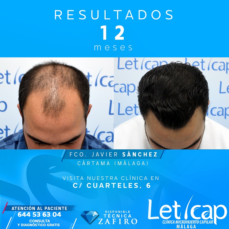 504725155 1277788887689340 2099053794721535720 n 1